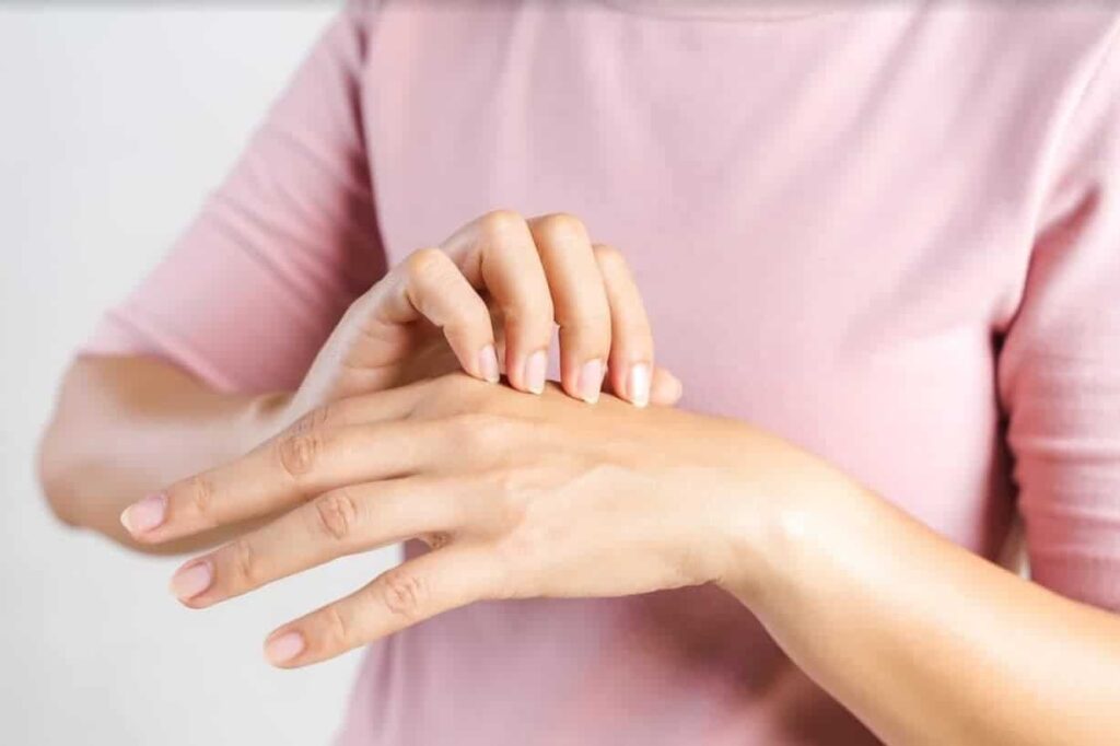 suva ispucala koza na rukama